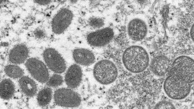 Photo of Monkeypox transmission may have gone undetected ‘for some time’