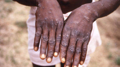 Photo of Animal-to-human diseases on the rise in Africa, warns UN health agency